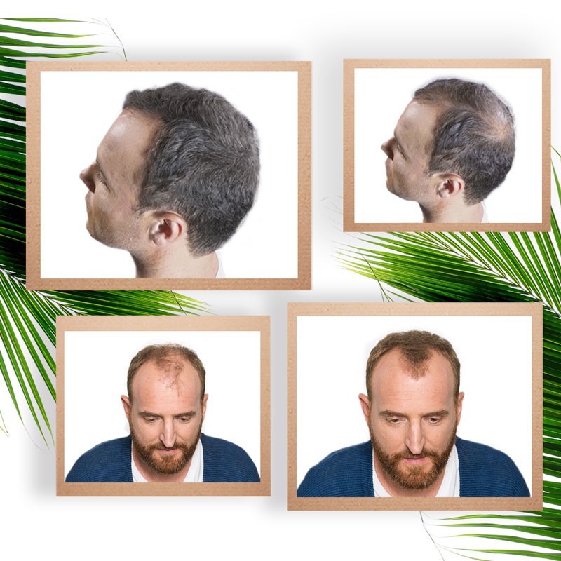 Starter Pack. Fibras Capilares 30gr + Fijador + Bomba + Optimizador - 6