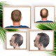 Optimizador de fibras capilares - 4