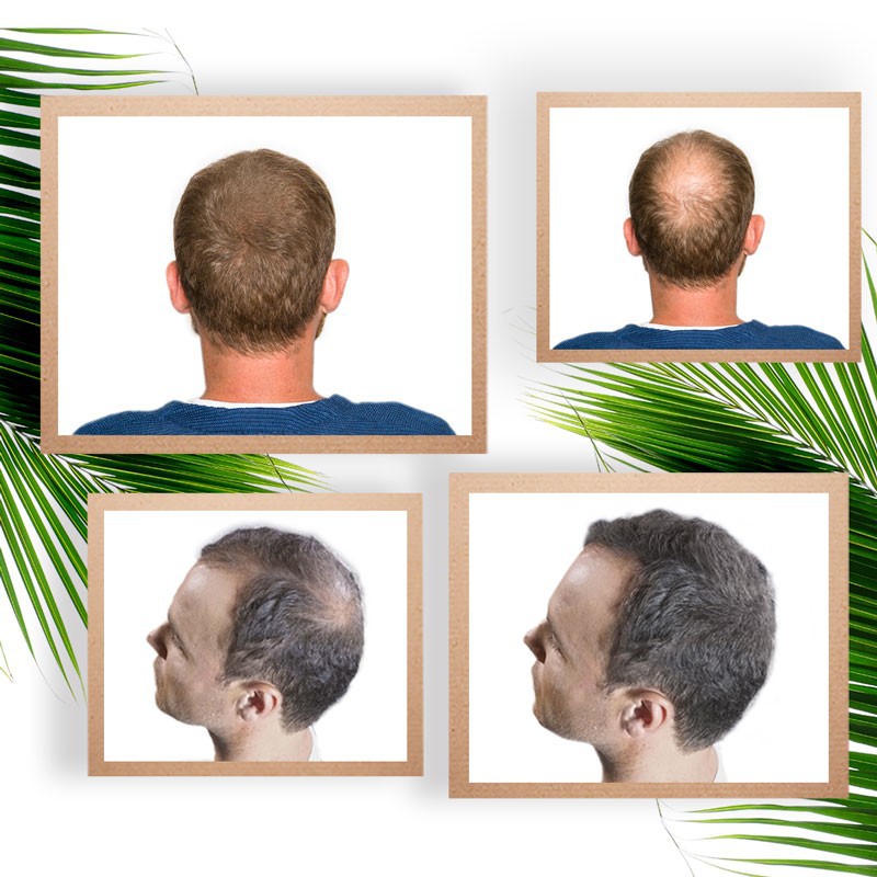 Optimierer für Haarfasern - 4