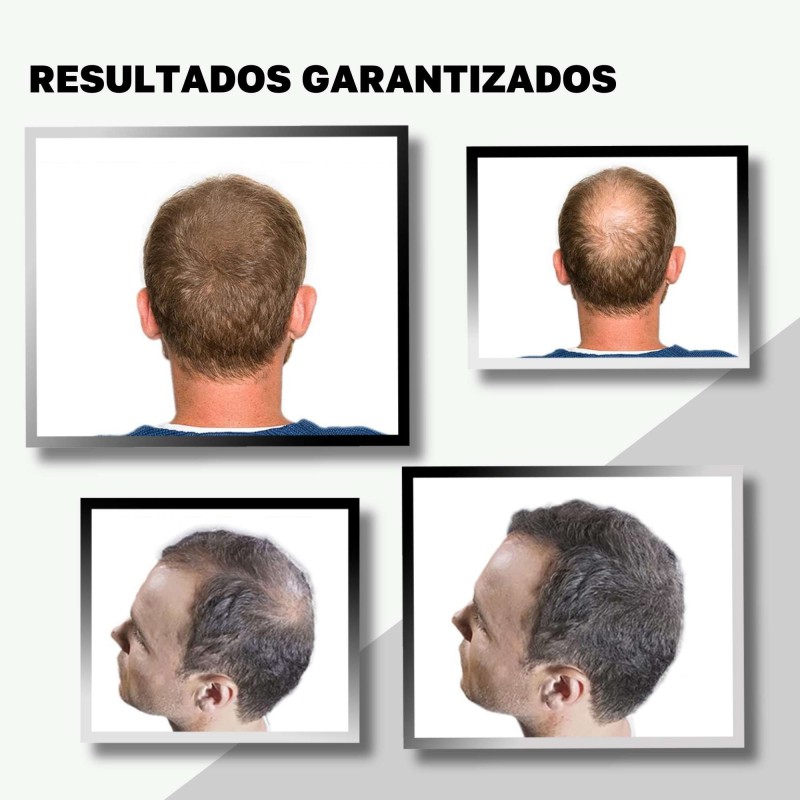 Fibras Capilares 30 gr - 5