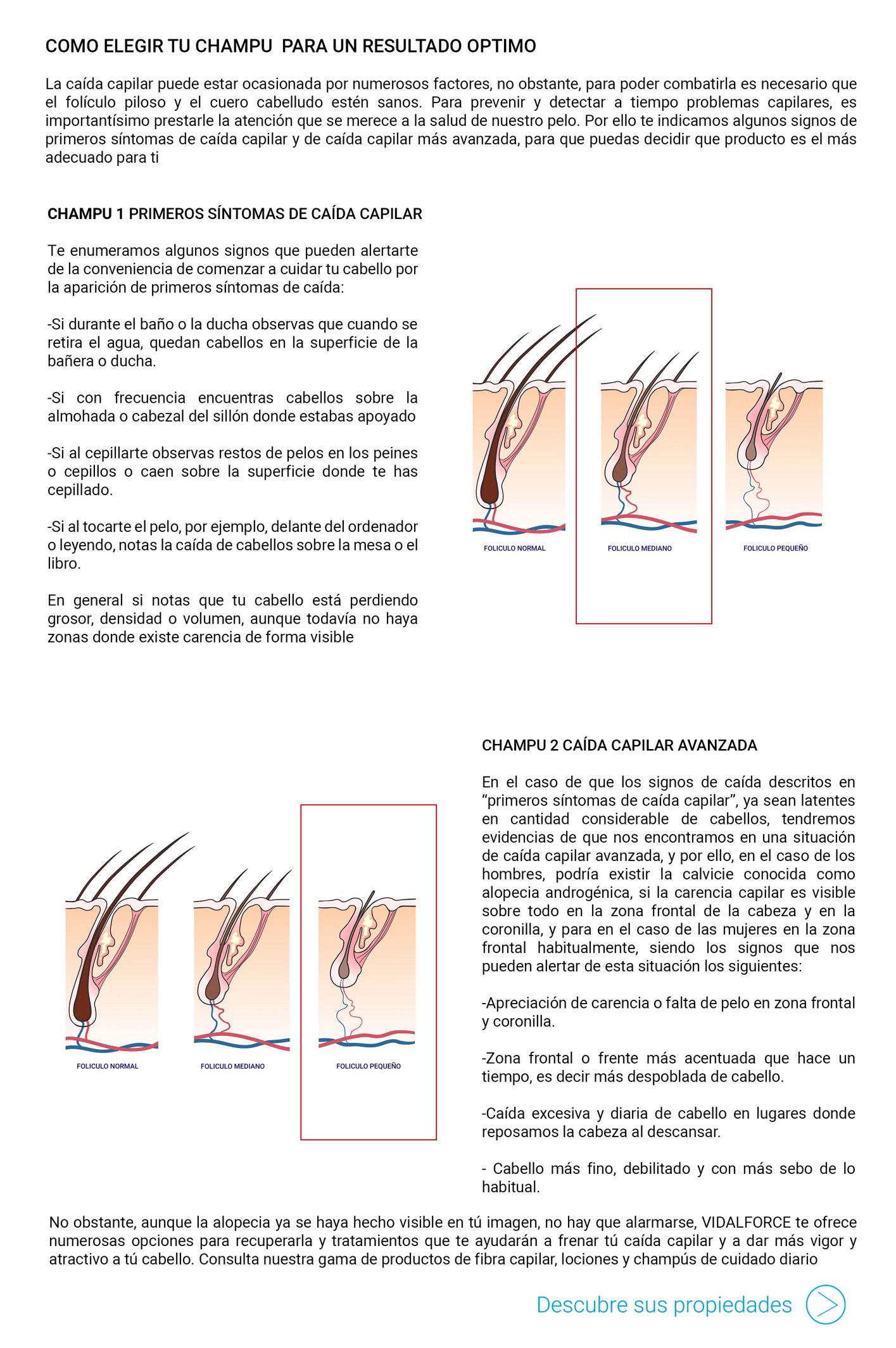 saber-que-tipo-de-alopecia-tienes.jpg