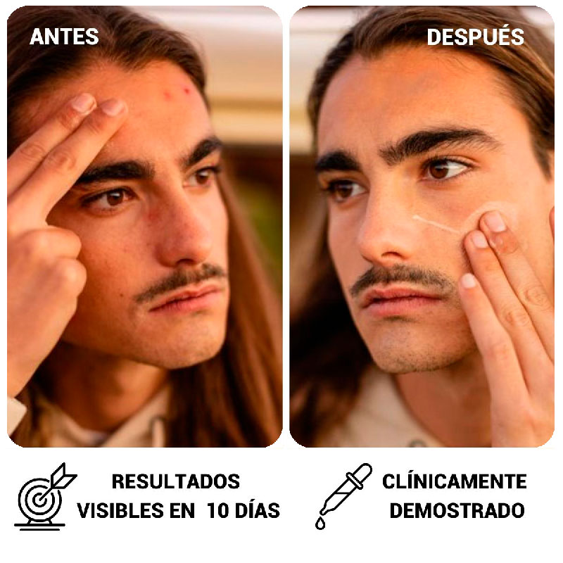 antes-y-despues-resultados-hurrricane.jpg